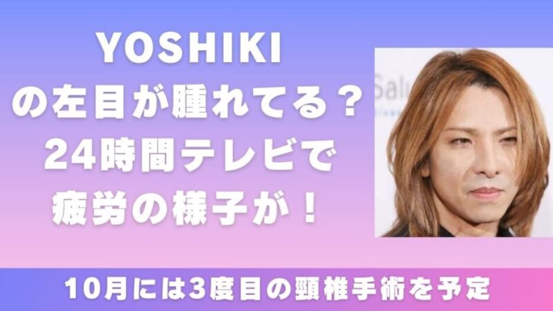 YOSHIKIの左目が腫れてる？24時間テレビで疲労の様子が！ 